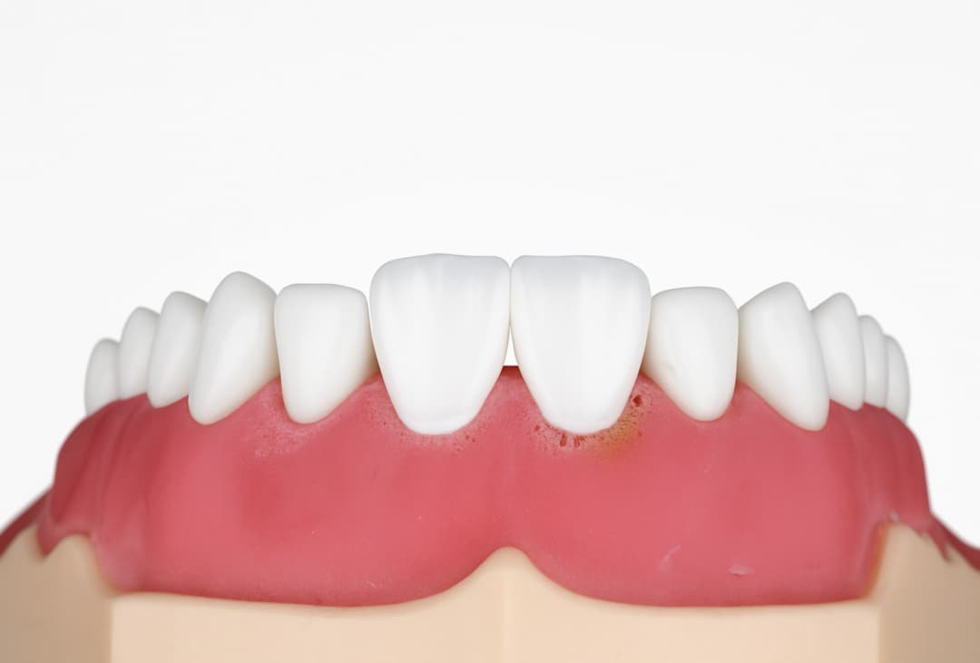 Rehabilitación Oral