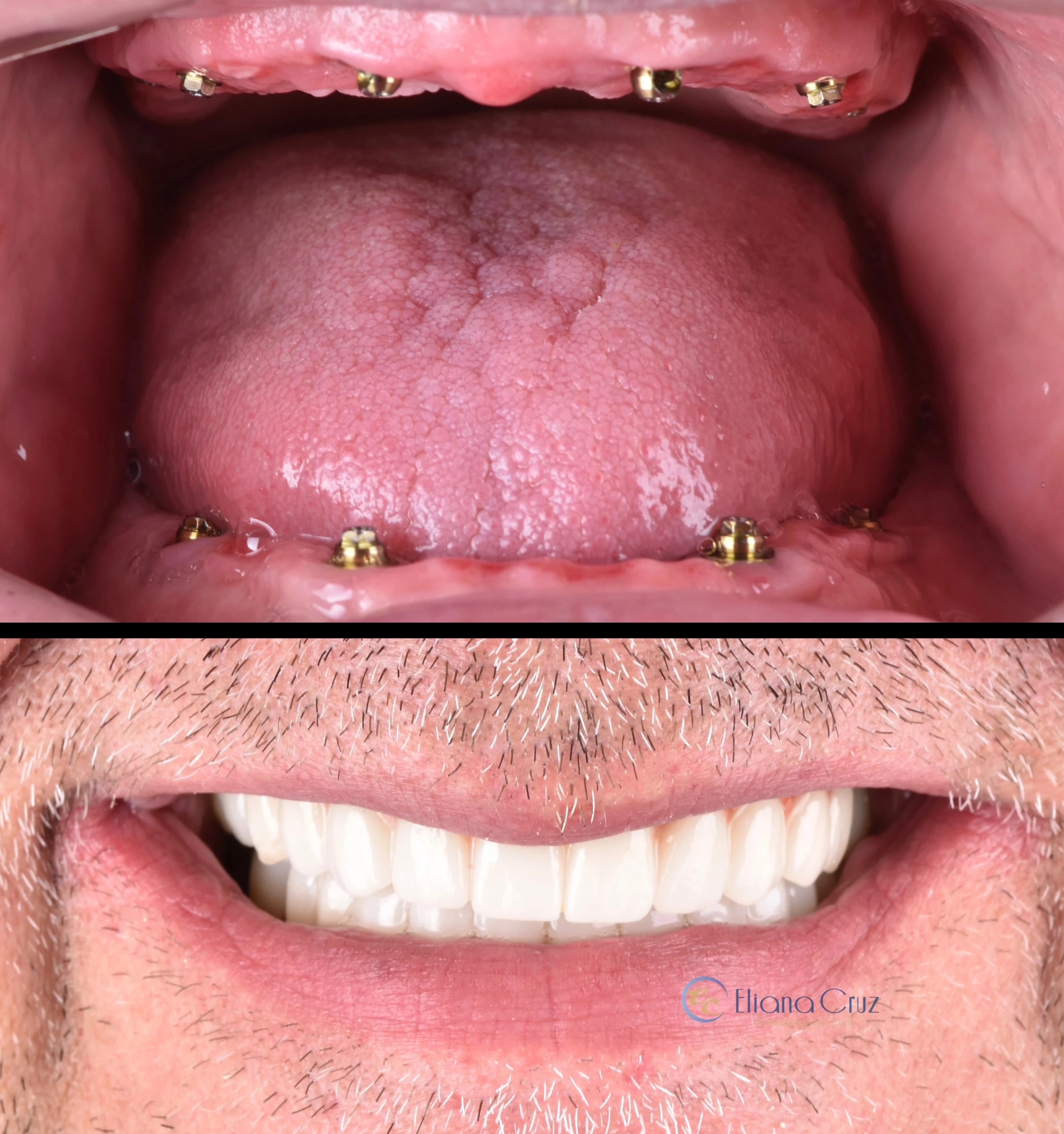 Resultado odontológico