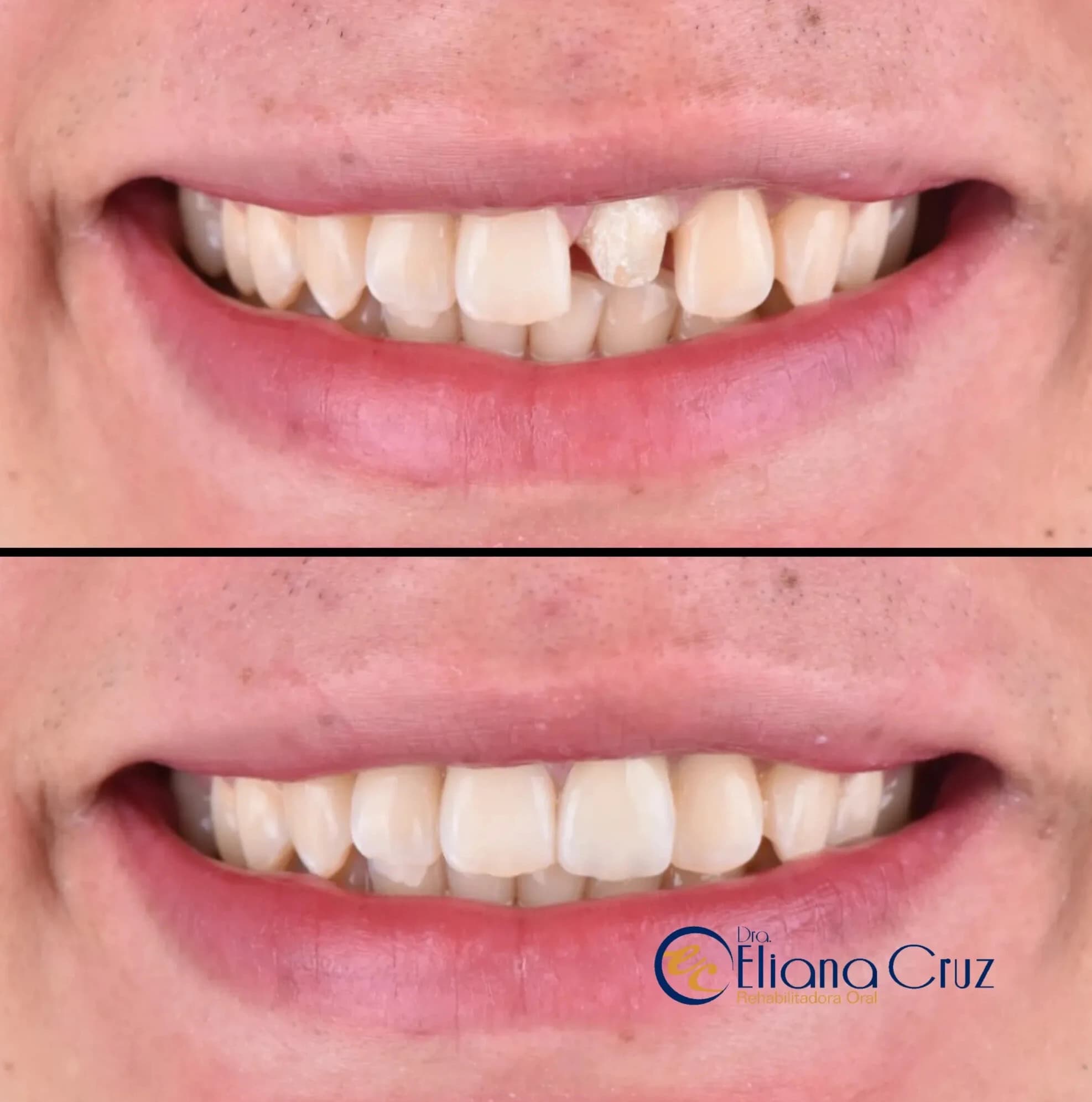 Resultado odontológico