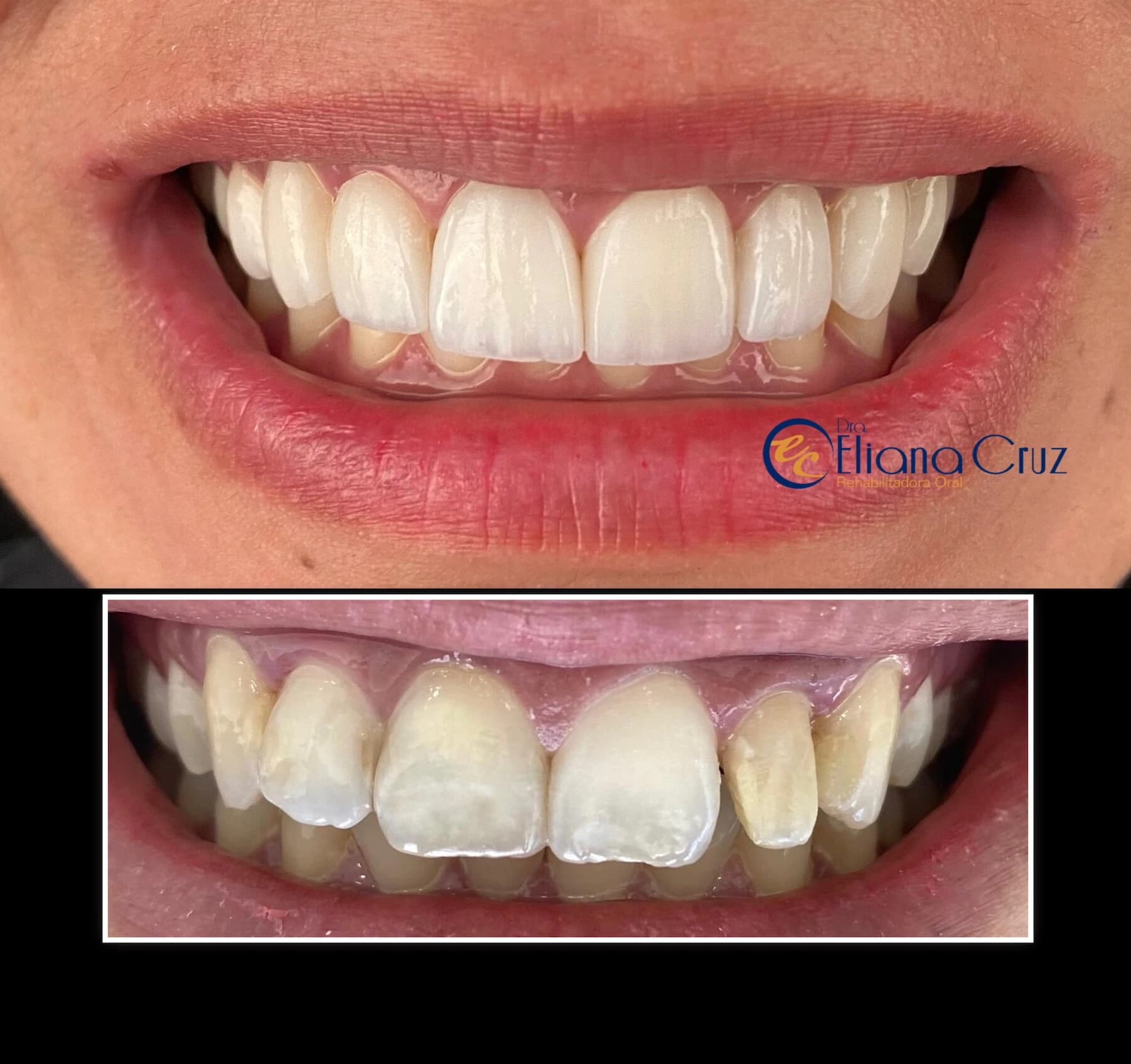 Resultado odontológico