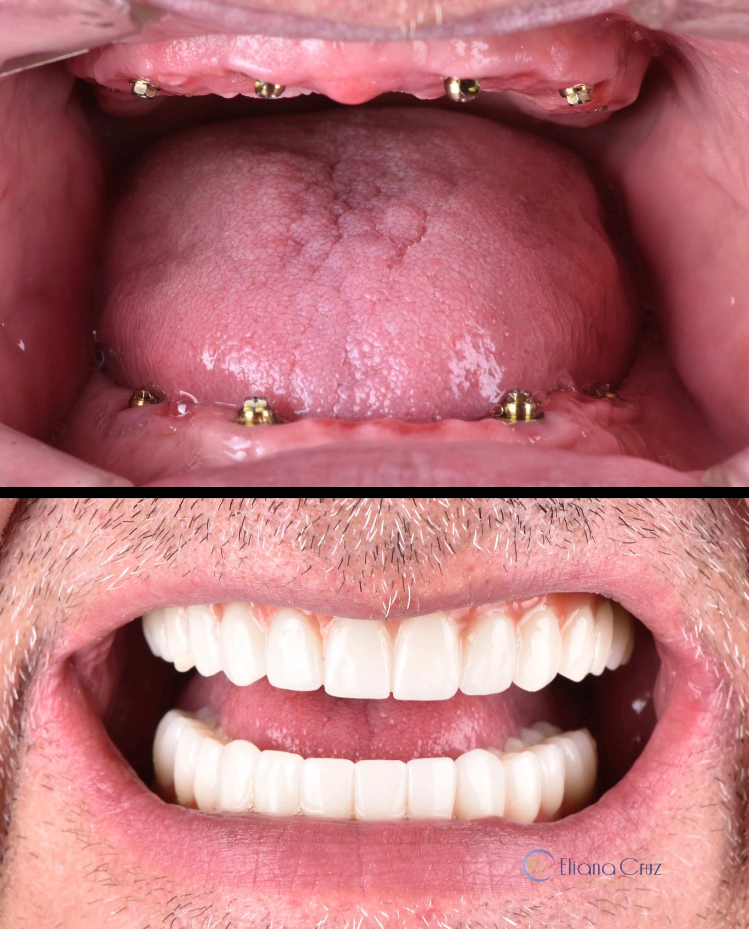 Resultado odontológico