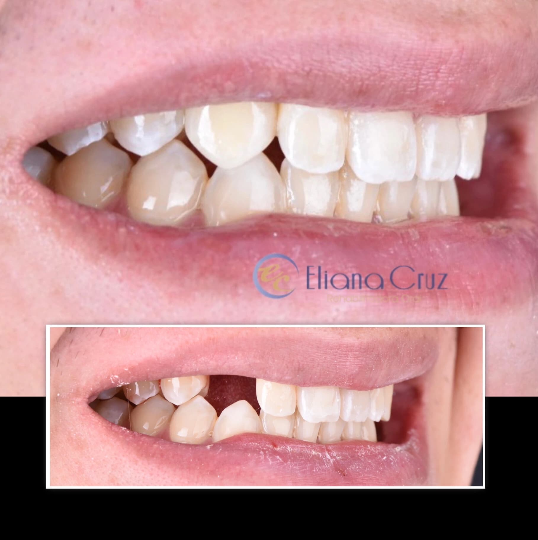 Resultado odontológico