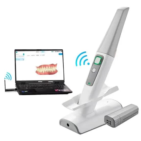 scanner intraoral 3D imagen 2